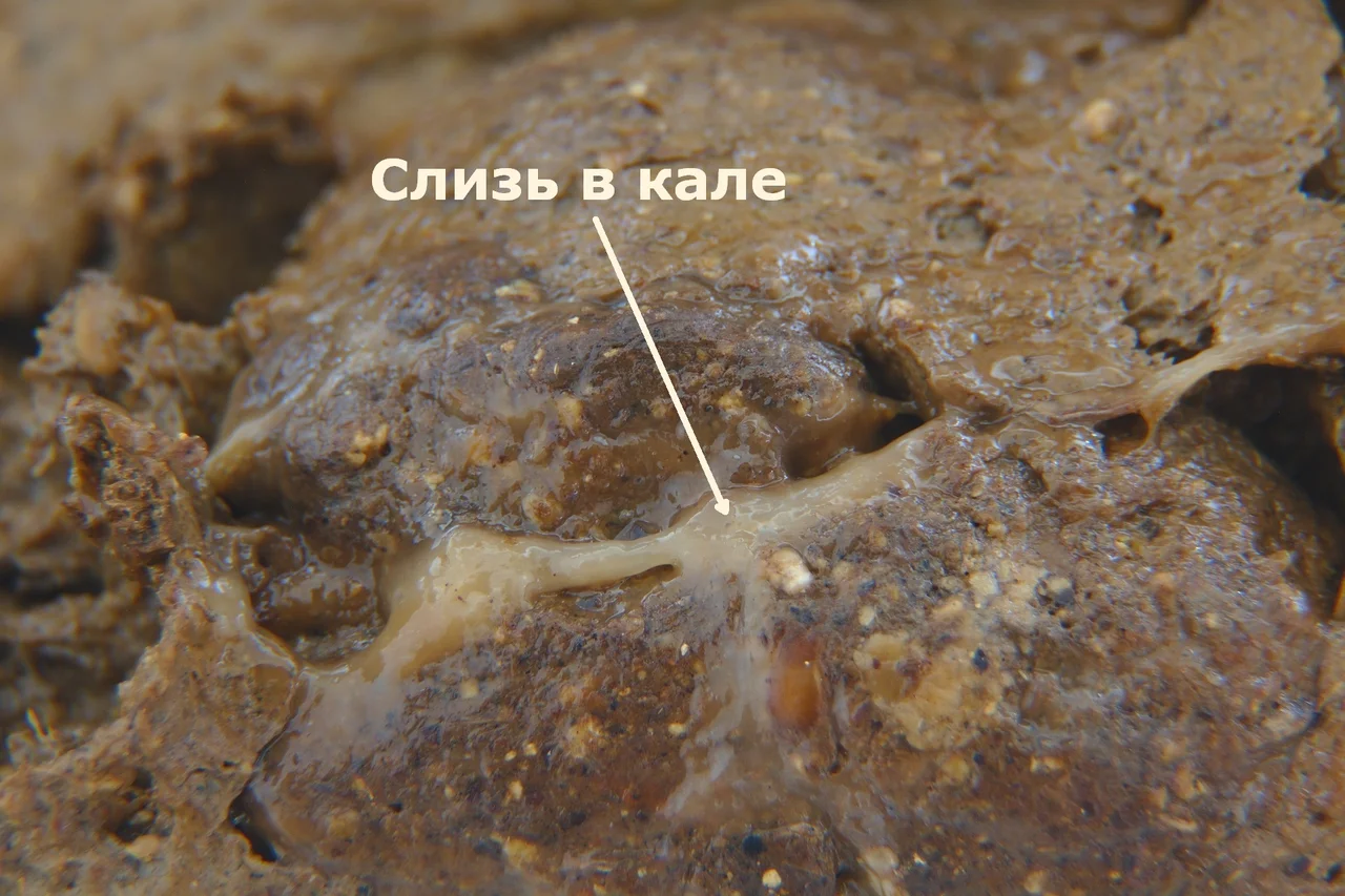 Слизь в кале крупным планом