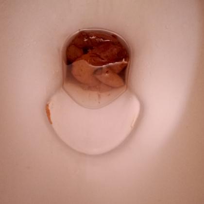 shit
