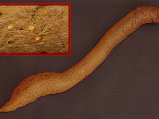 Как выглядит нормальный стул у женщин