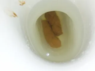 dvyniai