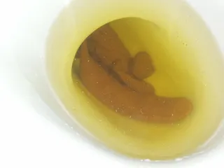 bananas