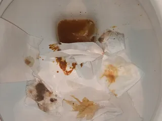 Gatves viduriavimo tesinys