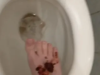 КАКАХА НА НОГЕ