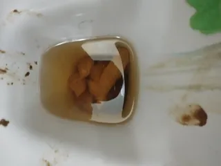 Неделю не срал