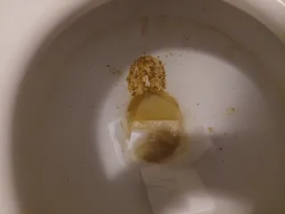 Бобовое пюре