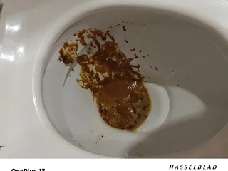 Жопный жидр