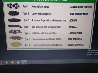 Типы какашек 3