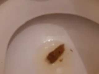 Просто кака