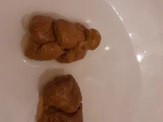 Просто кака