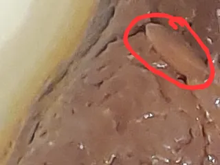 Непереварившийся грейпфрут