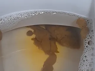 Говняшки из попы вылеташки