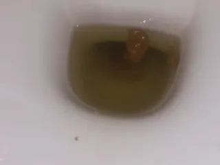 Нора морского угря