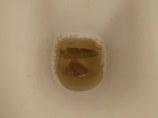 Спинка бегемотика