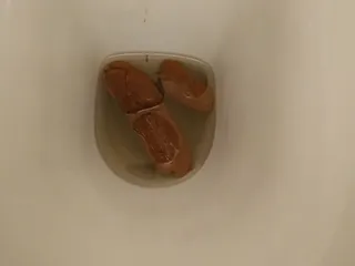 Колбоса иного рода