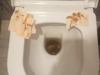 Жестко тужился