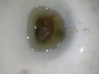 Йоу какашка