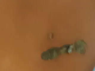 барон фекалий