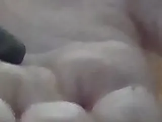 Какашка на руке