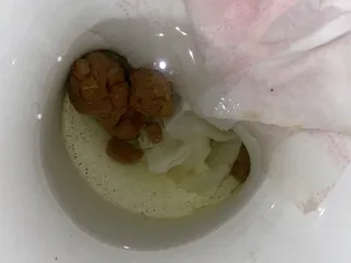 какашка из попы вылеташка