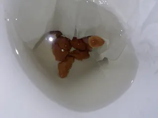 насрал маленькими какашками