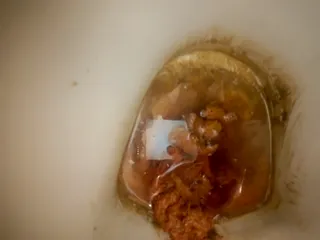 Покакала 2 раз за сегодня