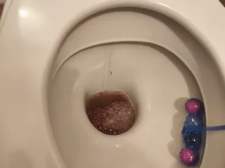 Смачный понос