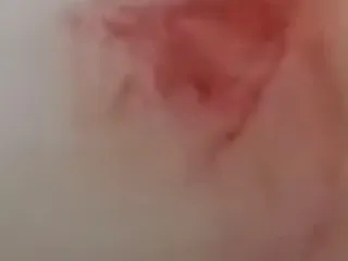 Понос понос понос