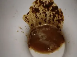 Понос это хорошо