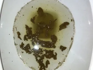 Ошметья ядерной какашки