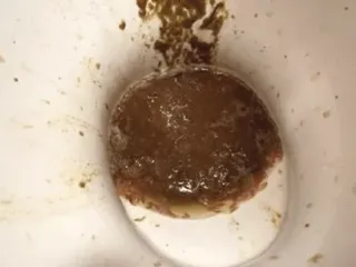 Понос это хорошо2