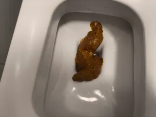 Задушенная Геркулесом змея