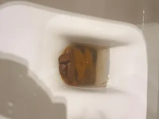 Бычий цепень