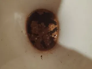 посрал поносом