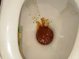 жидкая оранжевая мякоть в сортире