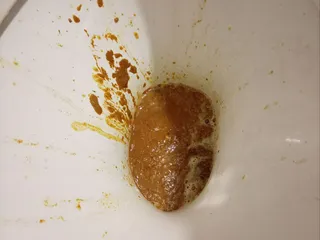 говно