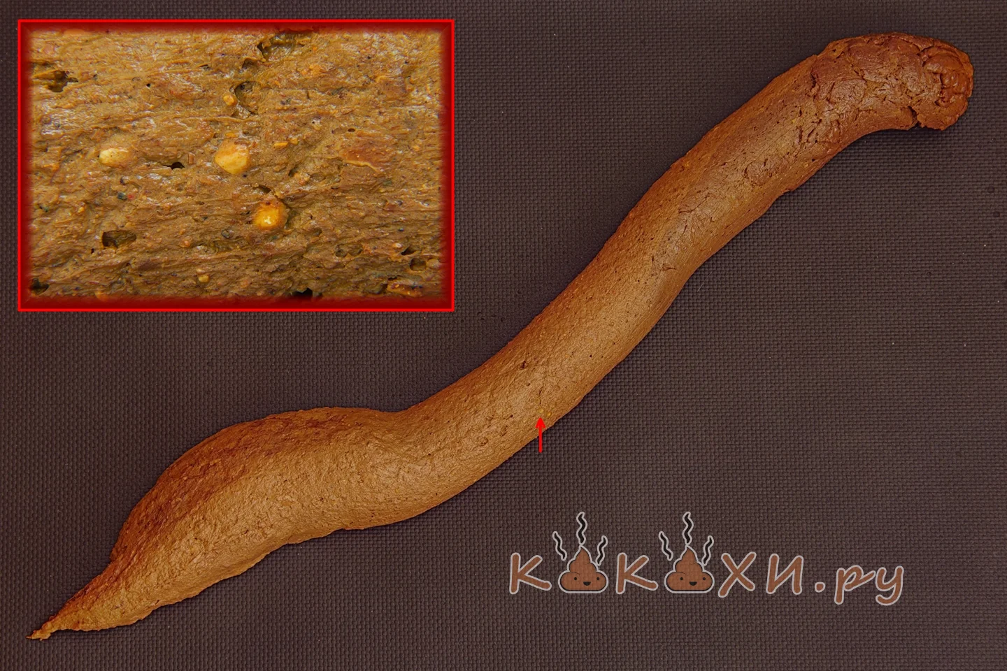 Как выглядит нормальный стул у женщин ( Колбоса )