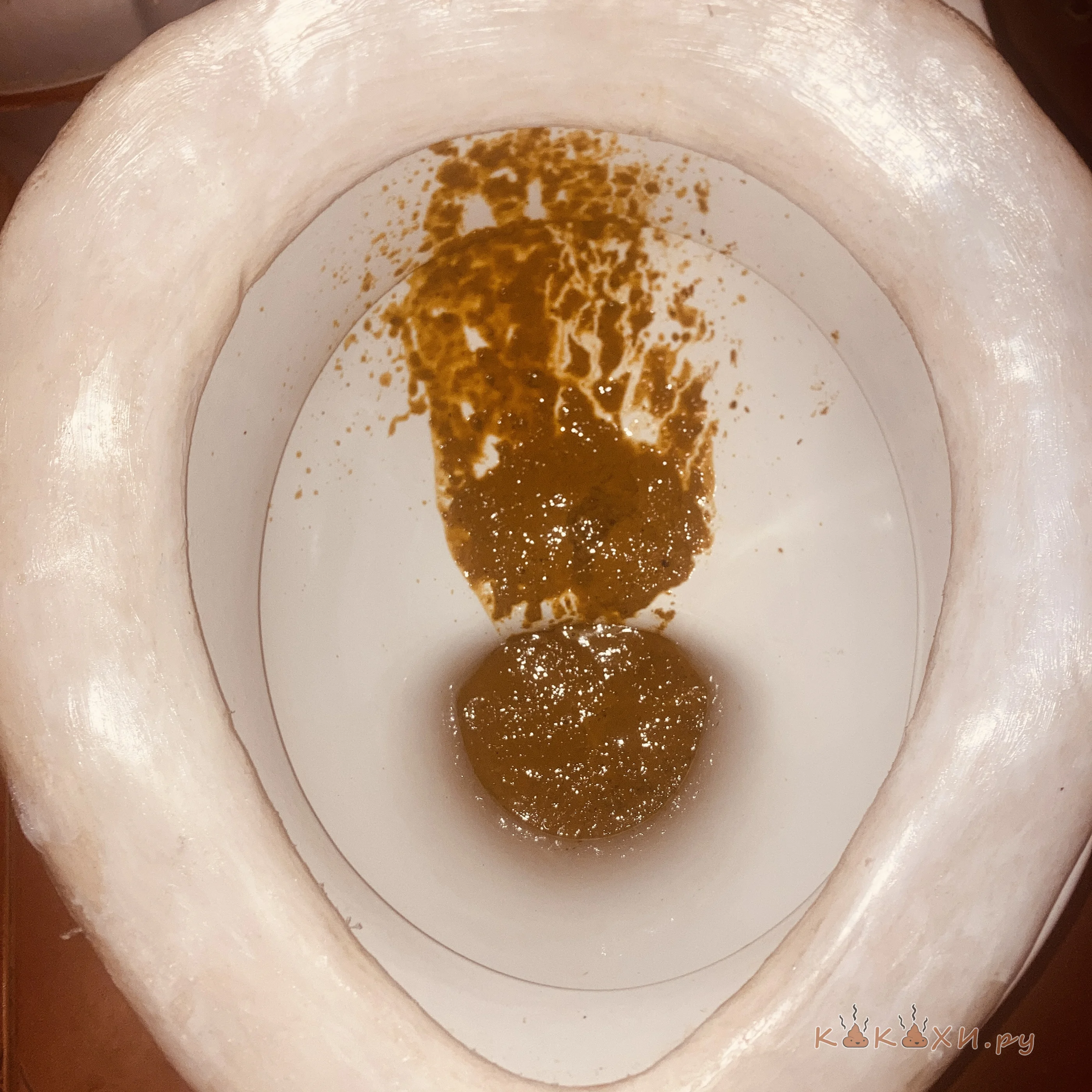 Понос ( Брызги )