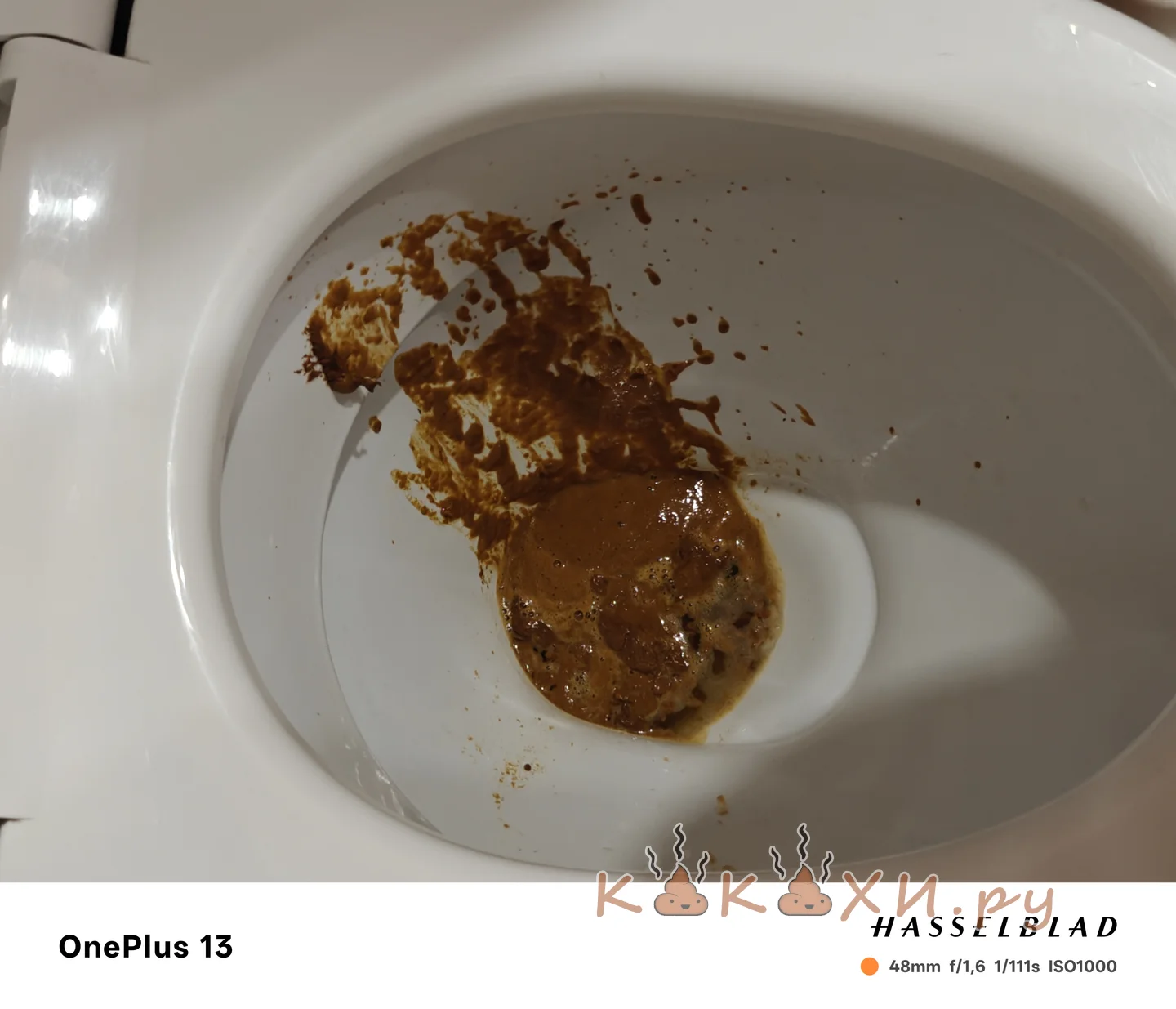 Жопный жидр ( Подлива )