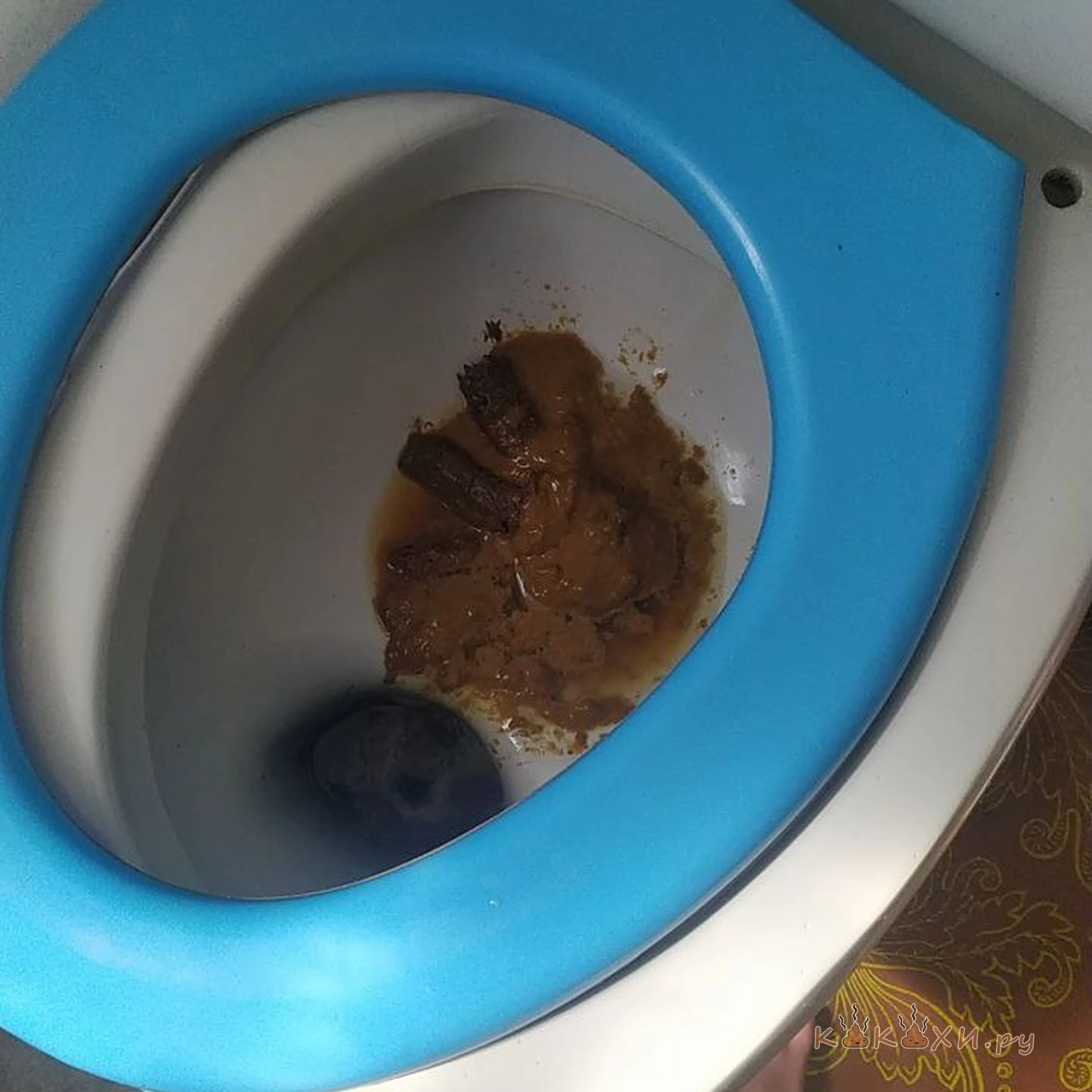 dritnya ( Тяжелые роды )