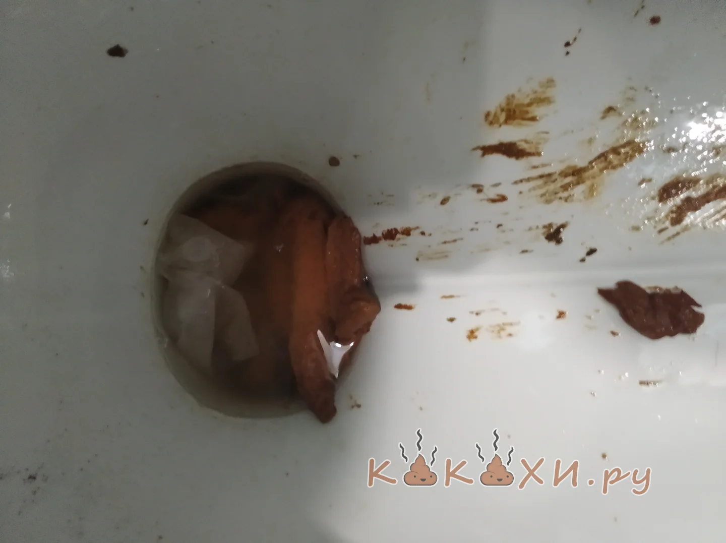 Давил ( Колбоса )