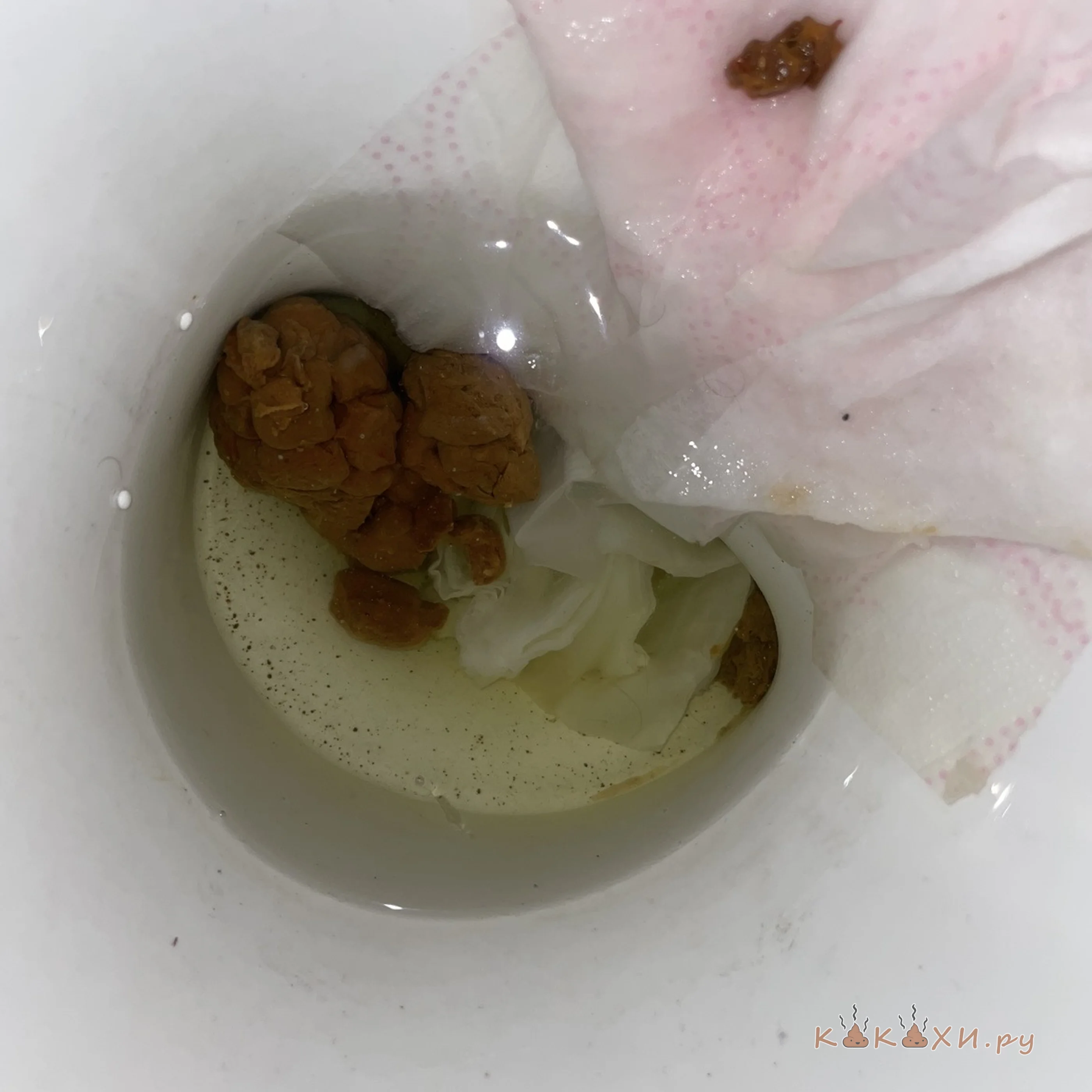 какашка из попы вылеташка ( Тяжелые роды )